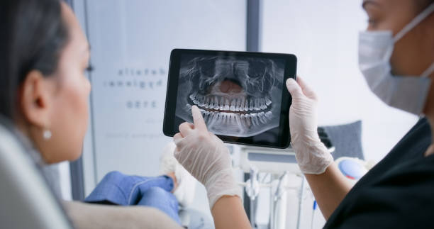 Licensed Wisdom Tooth Removal service in Collierville, CA - Smile Center Dentistry
